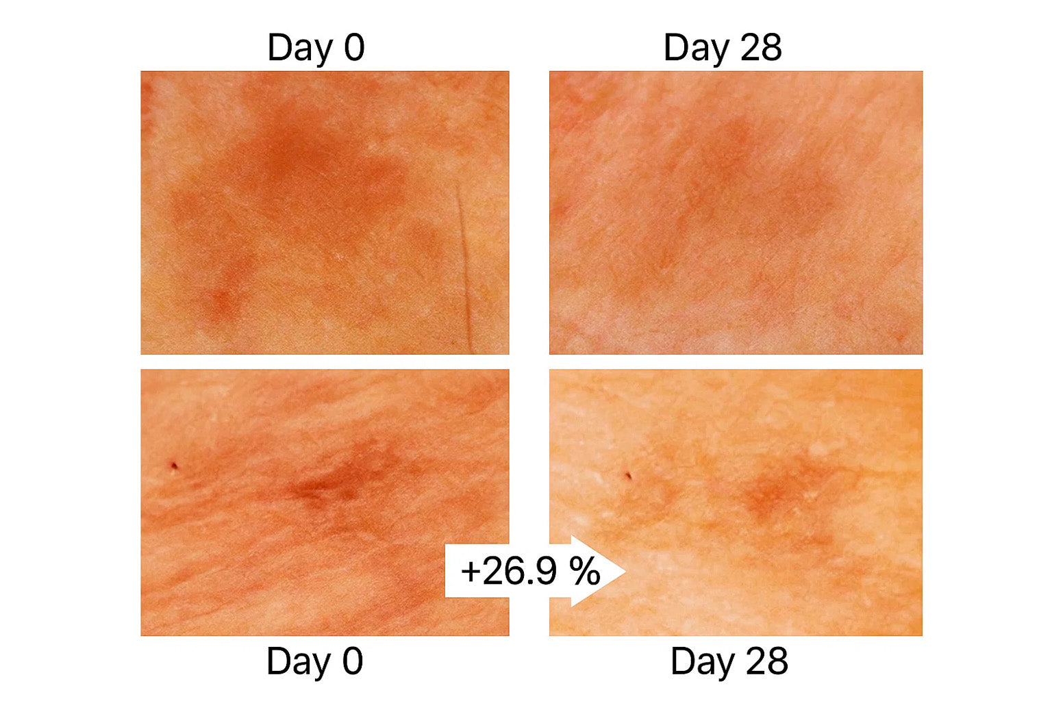 Meso pigment reduce 30ml